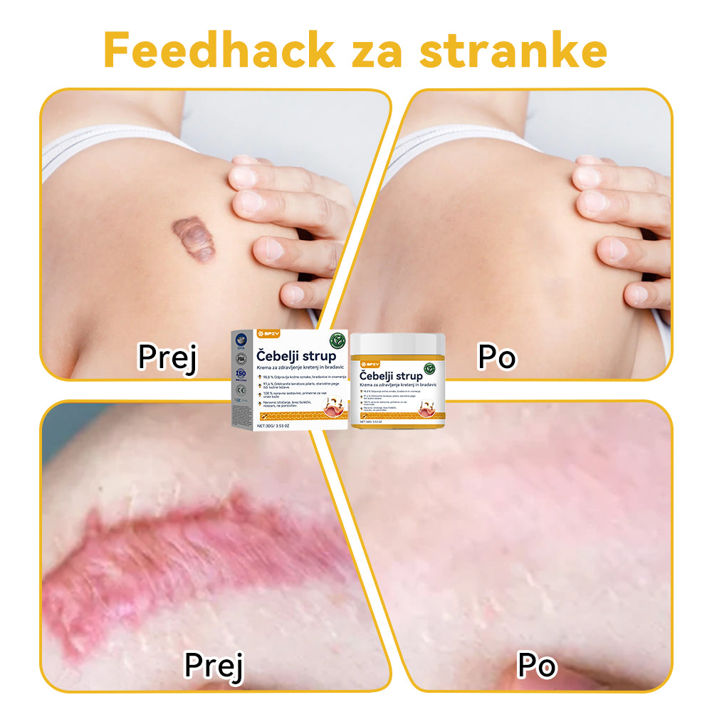 🍍🍍𝑺𝒑𝒛𝒗™ Č𝒆𝒃𝒆𝒍𝒋𝒊 𝒔𝒕𝒓𝒖𝒑 𝑲𝒓𝒆𝒎𝒂 𝒛𝒂 𝒛𝒅𝒓𝒂𝒗𝒍𝒋𝒆𝒏𝒋𝒆 𝒌𝒓𝒆𝒕𝒆𝒏𝒋 𝒊𝒏 𝒃𝒓𝒂𝒅𝒂𝒗𝒊𝒄 ⚡⚡(🧑⚕️𝑺𝒑𝒆𝒄𝒊𝒂𝒍𝒊𝒔𝒕 𝑫𝒆𝒓𝒎𝒂𝒕𝒐𝒍𝒐𝒈𝒊𝒔𝒕 𝑹𝒆𝒄𝒐𝒎𝒎𝒆𝒏𝒅𝒂𝒕𝒊𝒐𝒏🔥🔥𝒁𝒂𝒅𝒏𝒋𝒂 𝒑𝒓𝒐𝒎𝒐𝒄𝒊𝒋𝒂 𝒅𝒂𝒍𝒚 80% 𝒐𝒇𝒇)