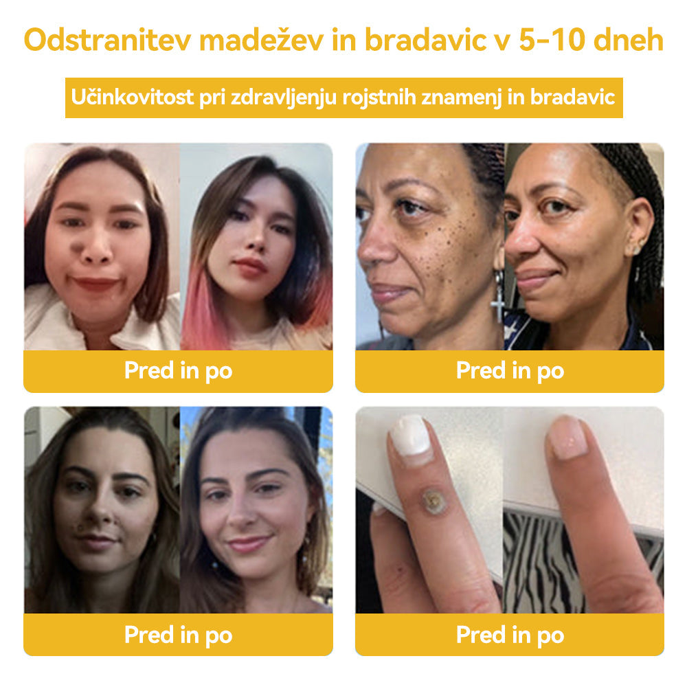 🍍🍍𝑺𝒑𝒛𝒗™ Č𝒆𝒃𝒆𝒍𝒋𝒊 𝒔𝒕𝒓𝒖𝒑 𝑲𝒓𝒆𝒎𝒂 𝒛𝒂 𝒛𝒅𝒓𝒂𝒗𝒍𝒋𝒆𝒏𝒋𝒆 𝒌𝒓𝒆𝒕𝒆𝒏𝒋 𝒊𝒏 𝒃𝒓𝒂𝒅𝒂𝒗𝒊𝒄 ⚡⚡(🧑⚕️𝑺𝒑𝒆𝒄𝒊𝒂𝒍𝒊𝒔𝒕 𝑫𝒆𝒓𝒎𝒂𝒕𝒐𝒍𝒐𝒈𝒊𝒔𝒕 𝑹𝒆𝒄𝒐𝒎𝒎𝒆𝒏𝒅𝒂𝒕𝒊𝒐𝒏🔥🔥𝒁𝒂𝒅𝒏𝒋𝒂 𝒑𝒓𝒐𝒎𝒐𝒄𝒊𝒋𝒂 𝒅𝒂𝒍𝒚 80% 𝒐𝒇𝒇)
