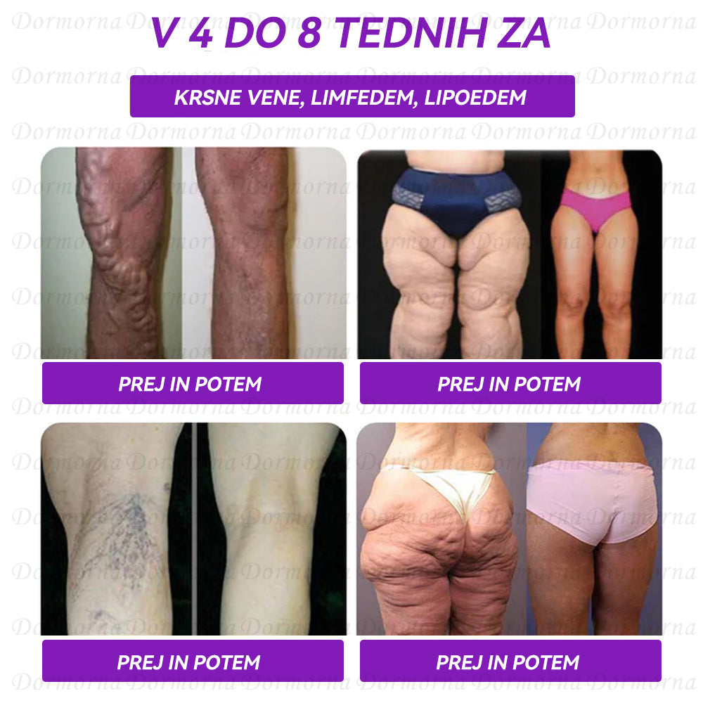 Univerza v Ljubljani, Medicinska fakulteta Priporočamo | Uradna trgovina | 𝐃𝐨𝐫𝐦𝐨𝐫𝐧𝐚® 🦋🦋𝐆𝐋𝐏-𝟏 𝐏𝐞𝐫𝐨𝐫𝐚𝐥𝐧𝐚 𝐓𝐞𝐤𝐨č𝐢𝐧𝐚--✅Revolucionarni GLP-1 znanstveni programi za nadzor sladkorja in hujšanje