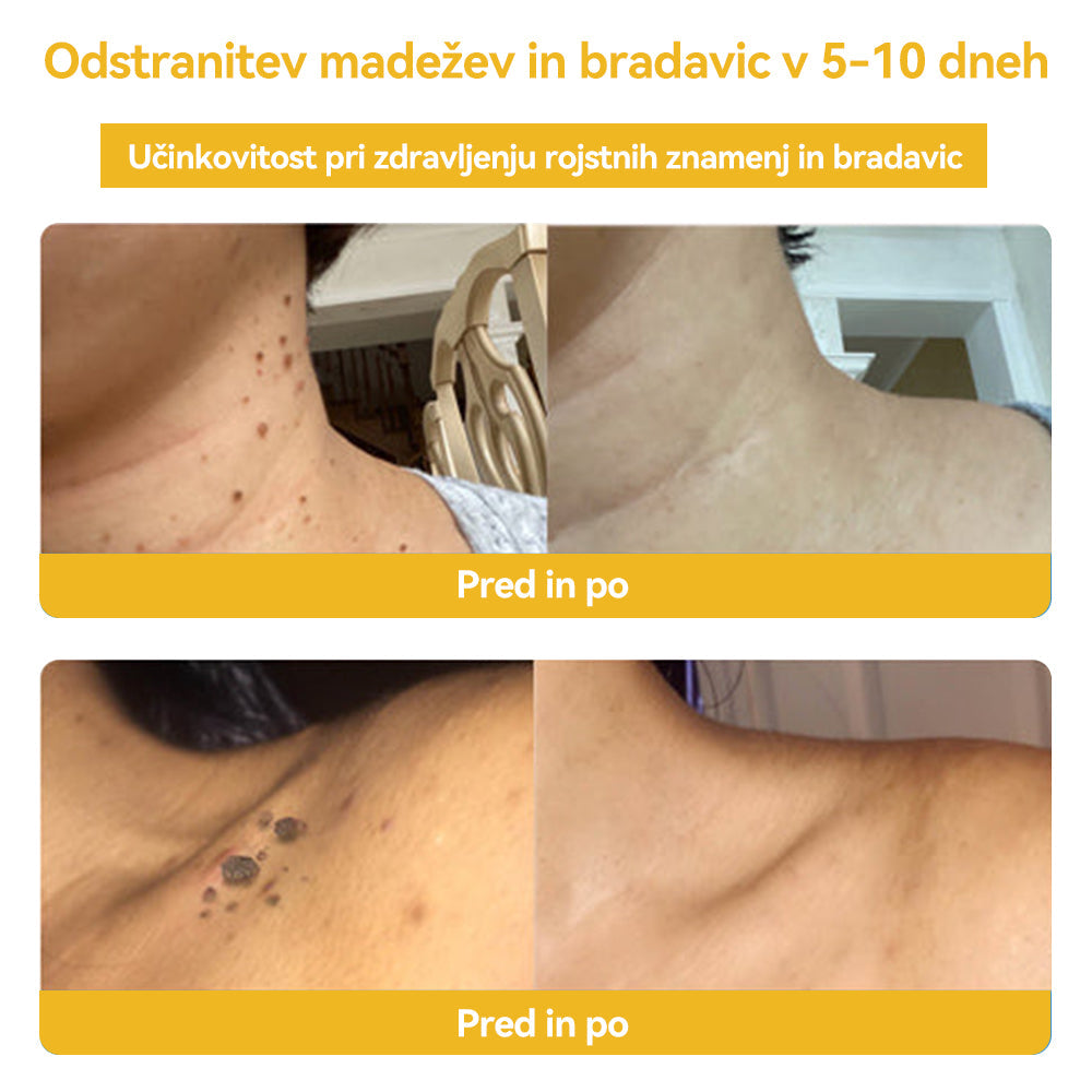 🍍🍍𝑺𝒑𝒛𝒗™ Č𝒆𝒃𝒆𝒍𝒋𝒊 𝒔𝒕𝒓𝒖𝒑 𝑲𝒓𝒆𝒎𝒂 𝒛𝒂 𝒛𝒅𝒓𝒂𝒗𝒍𝒋𝒆𝒏𝒋𝒆 𝒌𝒓𝒆𝒕𝒆𝒏𝒋 𝒊𝒏 𝒃𝒓𝒂𝒅𝒂𝒗𝒊𝒄 ⚡⚡(🧑⚕️𝑺𝒑𝒆𝒄𝒊𝒂𝒍𝒊𝒔𝒕 𝑫𝒆𝒓𝒎𝒂𝒕𝒐𝒍𝒐𝒈𝒊𝒔𝒕 𝑹𝒆𝒄𝒐𝒎𝒎𝒆𝒏𝒅𝒂𝒕𝒊𝒐𝒏🔥🔥𝒁𝒂𝒅𝒏𝒋𝒂 𝒑𝒓𝒐𝒎𝒐𝒄𝒊𝒋𝒂 𝒅𝒂𝒍𝒚 80% 𝒐𝒇𝒇)
