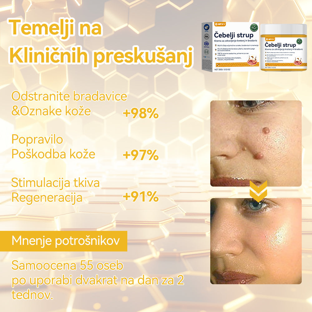 🍍🍍𝑺𝒑𝒛𝒗™ Č𝒆𝒃𝒆𝒍𝒋𝒊 𝒔𝒕𝒓𝒖𝒑 𝑲𝒓𝒆𝒎𝒂 𝒛𝒂 𝒛𝒅𝒓𝒂𝒗𝒍𝒋𝒆𝒏𝒋𝒆 𝒌𝒓𝒆𝒕𝒆𝒏𝒋 𝒊𝒏 𝒃𝒓𝒂𝒅𝒂𝒗𝒊𝒄 ⚡⚡(🧑⚕️𝑺𝒑𝒆𝒄𝒊𝒂𝒍𝒊𝒔𝒕 𝑫𝒆𝒓𝒎𝒂𝒕𝒐𝒍𝒐𝒈𝒊𝒔𝒕 𝑹𝒆𝒄𝒐𝒎𝒎𝒆𝒏𝒅𝒂𝒕𝒊𝒐𝒏🔥🔥𝒁𝒂𝒅𝒏𝒋𝒂 𝒑𝒓𝒐𝒎𝒐𝒄𝒊𝒋𝒂 𝒅𝒂𝒍𝒚 80% 𝒐𝒇𝒇)