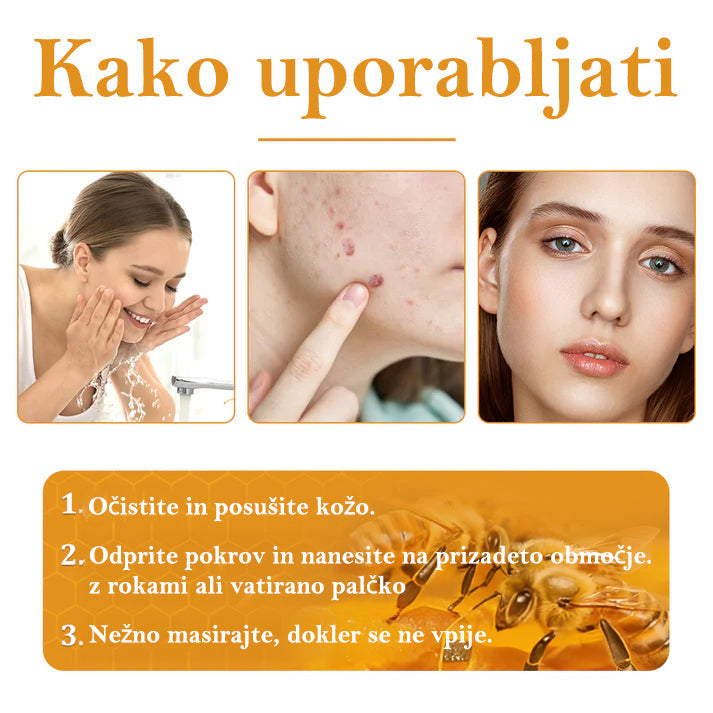 🐝𝐒𝐩𝐳𝐯® Č𝐞𝐛𝐞𝐥𝐣𝐢 𝐒𝐭𝐫𝐮𝐩 𝐊𝐫𝐞𝐦𝐚 𝐳𝐚 𝐨𝐝𝐬𝐭𝐫𝐚𝐧𝐣𝐞𝐯𝐚𝐧𝐣𝐞 𝐛𝐫𝐚𝐝𝐚𝐯𝐢𝐜 𝐢𝐧 𝐤𝐫𝐞𝐭𝐞𝐧𝐣, Certificirano s strani JAZMP (Slovenska agencija za zdravila in medicinske pripomočke) 💖 Zdravi bradavice, kožne izrastke, okužbe in keratozo, gladi neenakomerno kožo