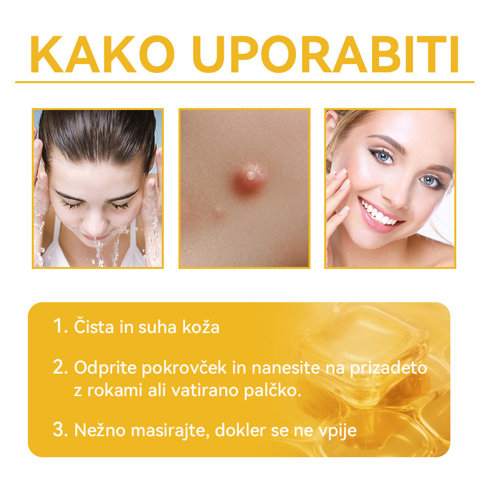 🍍🍍𝑺𝒑𝒛𝒗™ Č𝒆𝒃𝒆𝒍𝒋𝒊 𝒔𝒕𝒓𝒖𝒑 𝑲𝒓𝒆𝒎𝒂 𝒛𝒂 𝒛𝒅𝒓𝒂𝒗𝒍𝒋𝒆𝒏𝒋𝒆 𝒌𝒓𝒆𝒕𝒆𝒏𝒋 𝒊𝒏 𝒃𝒓𝒂𝒅𝒂𝒗𝒊𝒄 ⚡⚡(🧑⚕️𝑺𝒑𝒆𝒄𝒊𝒂𝒍𝒊𝒔𝒕 𝑫𝒆𝒓𝒎𝒂𝒕𝒐𝒍𝒐𝒈𝒊𝒔𝒕 𝑹𝒆𝒄𝒐𝒎𝒎𝒆𝒏𝒅𝒂𝒕𝒊𝒐𝒏🔥🔥𝒁𝒂𝒅𝒏𝒋𝒂 𝒑𝒓𝒐𝒎𝒐𝒄𝒊𝒋𝒂 𝒅𝒂𝒍𝒚 80% 𝒐𝒇𝒇)