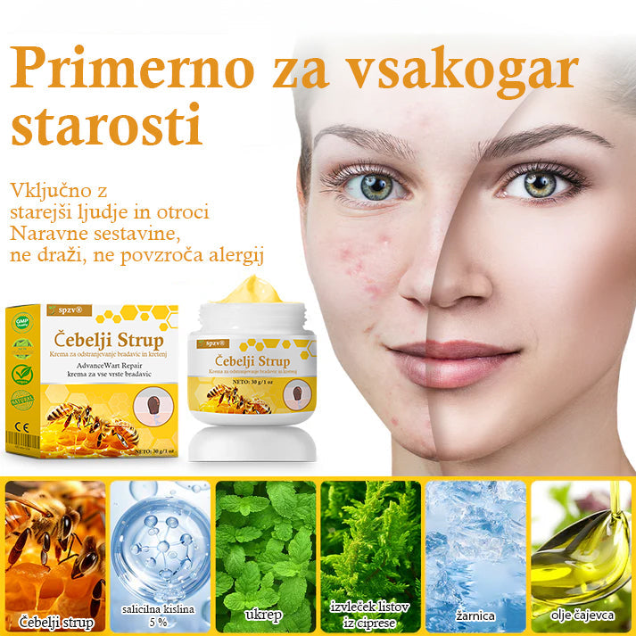 🐝𝐒𝐩𝐳𝐯® Č𝐞𝐛𝐞𝐥𝐣𝐢 𝐒𝐭𝐫𝐮𝐩 𝐊𝐫𝐞𝐦𝐚 𝐳𝐚 𝐨𝐝𝐬𝐭𝐫𝐚𝐧𝐣𝐞𝐯𝐚𝐧𝐣𝐞 𝐛𝐫𝐚𝐝𝐚𝐯𝐢𝐜 𝐢𝐧 𝐤𝐫𝐞𝐭𝐞𝐧𝐣, Certificirano s strani JAZMP (Slovenska agencija za zdravila in medicinske pripomočke) 💖 Zdravi bradavice, kožne izrastke, okužbe in keratozo, gladi neenakomerno kožo