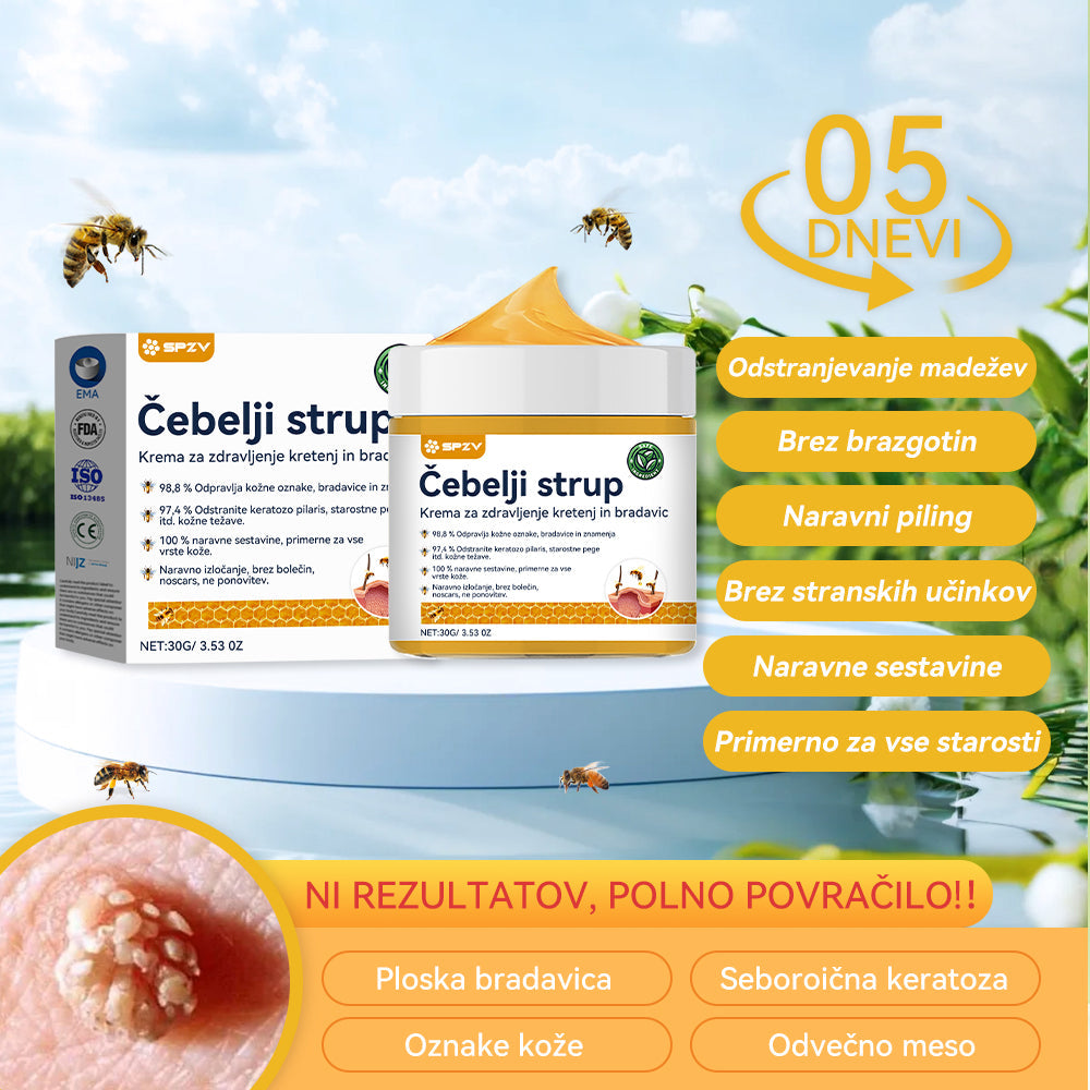 🍍🍍𝑺𝒑𝒛𝒗™ Č𝒆𝒃𝒆𝒍𝒋𝒊 𝒔𝒕𝒓𝒖𝒑 𝑲𝒓𝒆𝒎𝒂 𝒛𝒂 𝒛𝒅𝒓𝒂𝒗𝒍𝒋𝒆𝒏𝒋𝒆 𝒌𝒓𝒆𝒕𝒆𝒏𝒋 𝒊𝒏 𝒃𝒓𝒂𝒅𝒂𝒗𝒊𝒄 ⚡⚡(🧑⚕️𝑺𝒑𝒆𝒄𝒊𝒂𝒍𝒊𝒔𝒕 𝑫𝒆𝒓𝒎𝒂𝒕𝒐𝒍𝒐𝒈𝒊𝒔𝒕 𝑹𝒆𝒄𝒐𝒎𝒎𝒆𝒏𝒅𝒂𝒕𝒊𝒐𝒏🔥🔥𝒁𝒂𝒅𝒏𝒋𝒂 𝒑𝒓𝒐𝒎𝒐𝒄𝒊𝒋𝒂 𝒅𝒂𝒍𝒚 80% 𝒐𝒇𝒇)