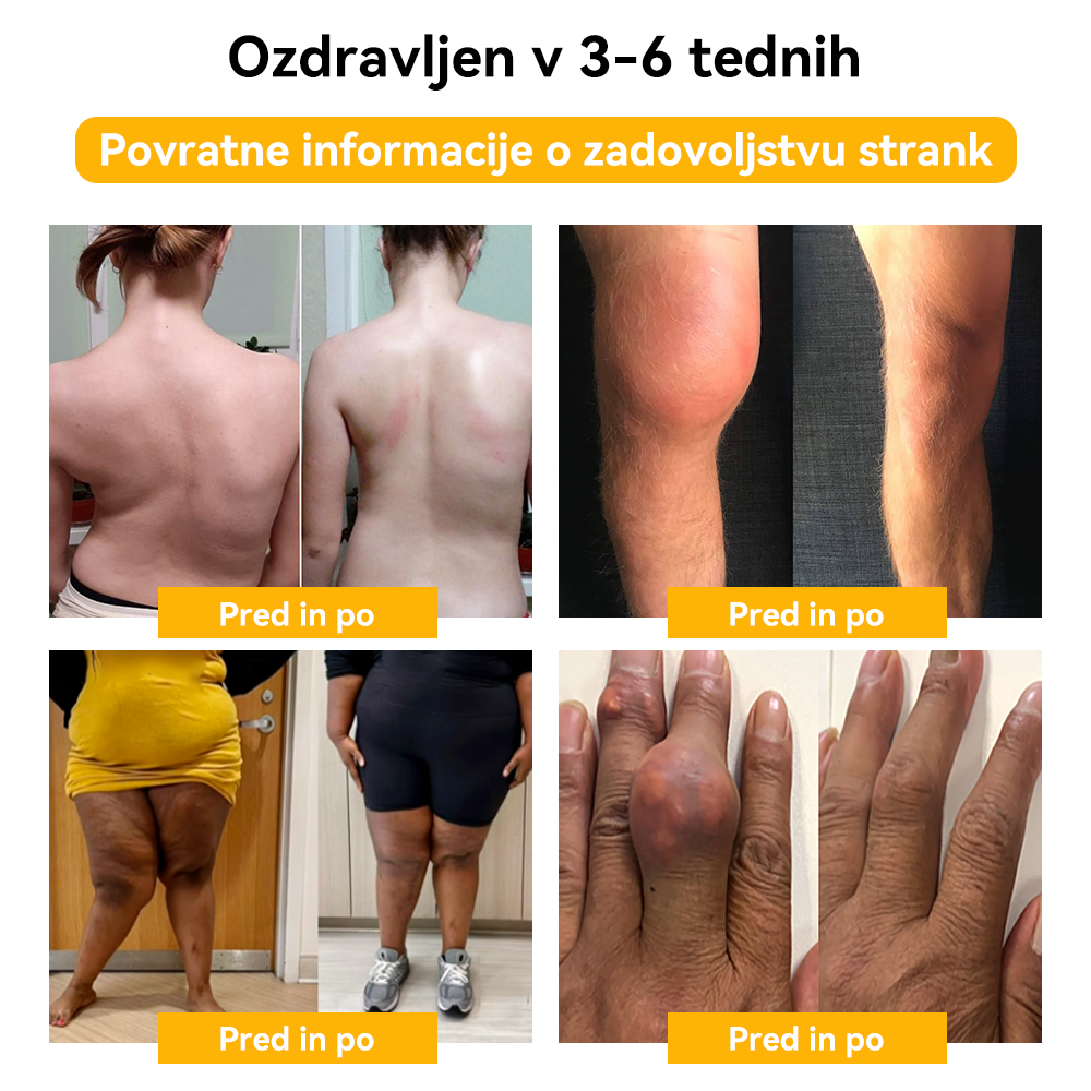 🦉𝐒𝐩𝐳𝐯™ Č𝐞𝐛𝐞𝐥𝐣𝐢 𝐒𝐭𝐫𝐮𝐩 𝐒𝐤𝐥𝐞𝐩𝐢 & 𝐊𝐨𝐬𝐭𝐢 𝐙𝐝𝐫𝐚𝐯𝐥𝐣𝐞𝐧𝐣𝐞 𝐊𝐫𝐞𝐦𝐚 🐝(𝐢𝐳𝐯𝐥𝐞č𝐞𝐤 𝐧𝐨𝐯𝐨𝐳𝐞𝐥𝐚𝐧𝐝𝐬𝐤𝐢𝐡 č𝐞𝐛𝐞𝐥 𝐣𝐞 𝐬𝐩𝐞𝐜𝐢𝐚𝐥𝐢𝐳𝐢𝐫𝐚𝐧 𝐳𝐚 𝐨𝐫𝐭𝐨𝐩𝐞𝐝𝐬𝐤𝐞 𝐛𝐨𝐥𝐞𝐳𝐧𝐢 𝐢𝐧 𝐛𝐨𝐥𝐞č𝐢𝐧𝐞 𝐩𝐫𝐢 𝐚𝐫𝐭𝐫𝐢𝐭𝐢𝐬𝐮)