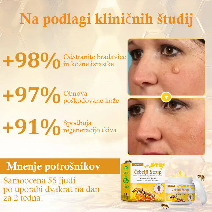 🐝𝐒𝐩𝐳𝐯® Č𝐞𝐛𝐞𝐥𝐣𝐢 𝐒𝐭𝐫𝐮𝐩 𝐊𝐫𝐞𝐦𝐚 𝐳𝐚 𝐨𝐝𝐬𝐭𝐫𝐚𝐧𝐣𝐞𝐯𝐚𝐧𝐣𝐞 𝐛𝐫𝐚𝐝𝐚𝐯𝐢𝐜 𝐢𝐧 𝐤𝐫𝐞𝐭𝐞𝐧𝐣, Certificirano s strani JAZMP (Slovenska agencija za zdravila in medicinske pripomočke) 💖 Zdravi bradavice, kožne izrastke, okužbe in keratozo, gladi neenakomerno kožo