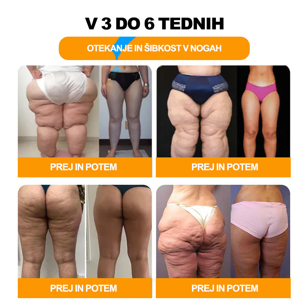 💎📦Zadnji dan, da bi dobili 70% OFF: Tnnedey® 𝑽č𝒆𝒍í 𝒋𝒆𝒅 𝒂 30 𝒃𝒚𝒍𝒊𝒏𝒏é 𝒅𝒆𝒕𝒐𝒙𝒊𝒌𝒂č𝒏é 𝒈𝒖ľôč𝒌𝒚 𝒏𝒂 𝒌ú𝒑𝒆ľ 𝒏ô𝒉 𝒑𝒓𝒆 𝒕𝒗𝒂𝒓𝒐𝒗𝒂𝒏𝒊𝒆 𝒕𝒆𝒍𝒂- Priporoča Ameriška limfna akademija (ALA)🧀