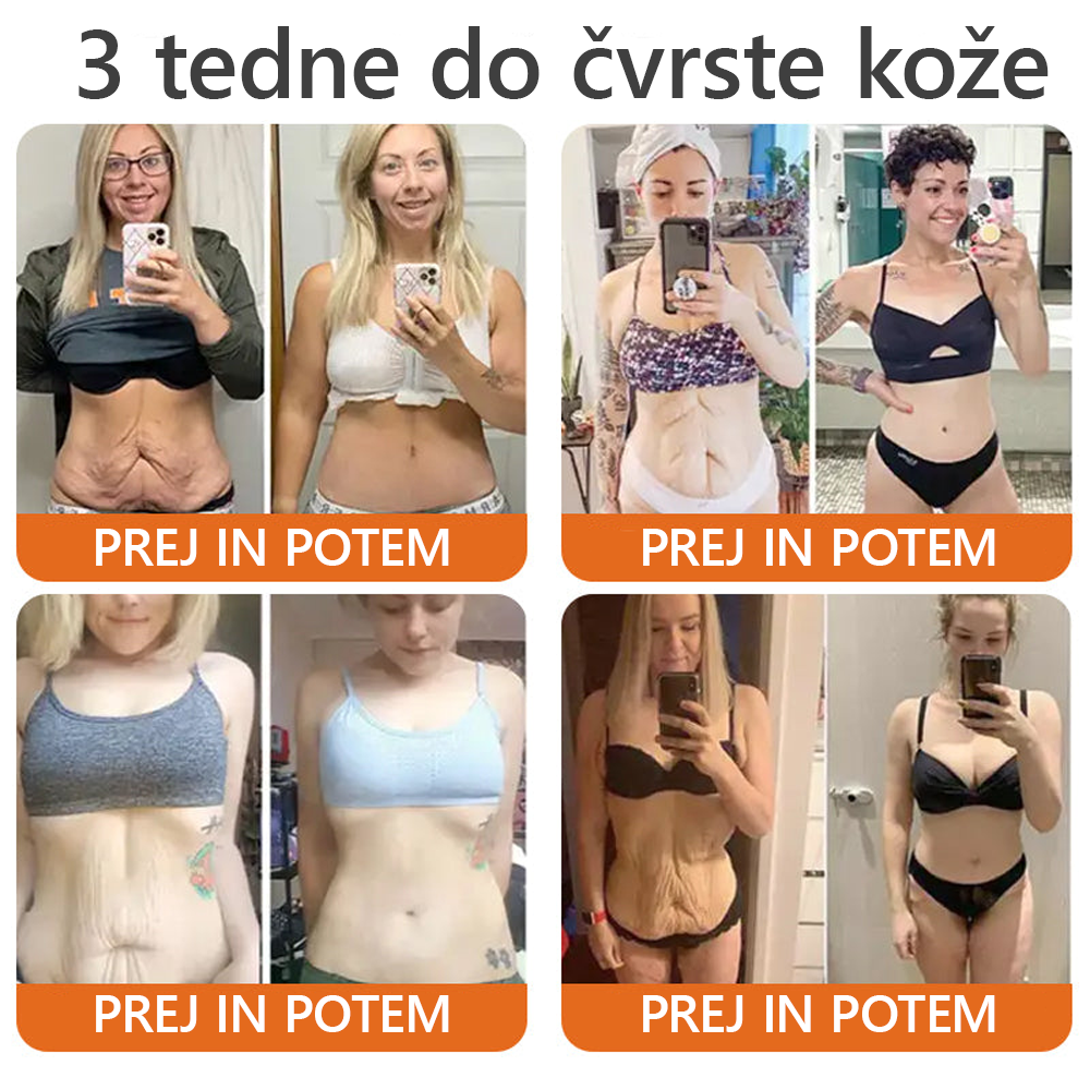 Izdelano in poslano iz Slovenije ✨✨Dormorna® Čebelji strup Celovita krema 🔥 ZADNJI DAN 80 % CENEJE💎💎
