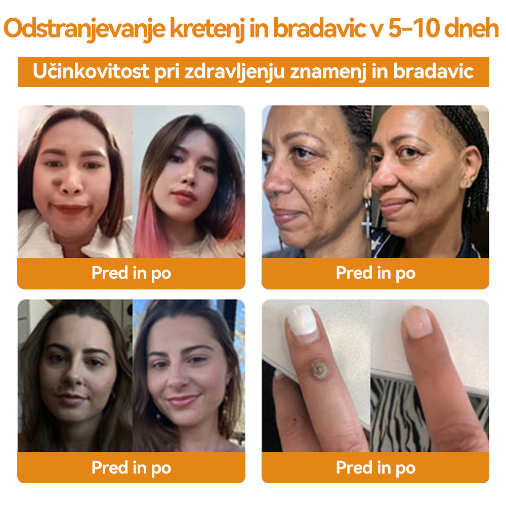 đĽđđŹđ¨đąđ⢠Äđđđđđđ đ đĄđđ˘đ đžđđđđ đ§đ đđđ đĄđđđđđđŁđđđđ đđđđđđŁđđ đđ đđđđĄđđđ( đ¨ââđ´đ´đˇ đđ
đźđđđ
đÄđ´)đđ (đĽđ§đđđđđ đđđ đđđđđđđđđ 80% đđđđ˘đ đĄ)đĽđĽ