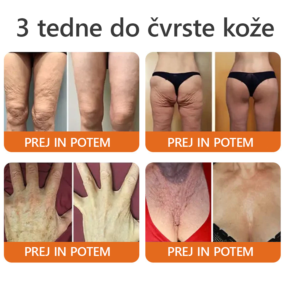 Izdelano in poslano iz Slovenije ✨✨Dormorna® Čebelji strup Celovita krema 🔥 ZADNJI DAN 80 % CENEJE💎💎