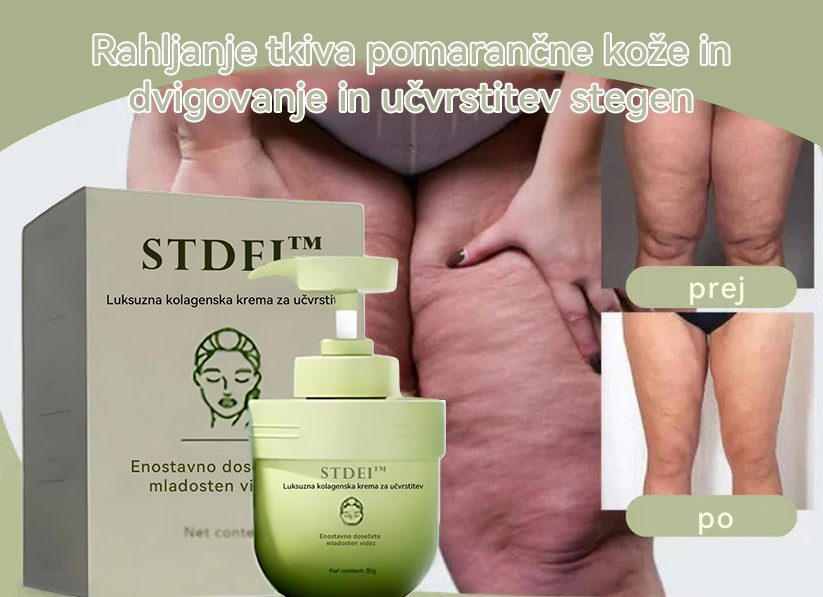 STDEI™ 💖 Luksuzna kolagenska krema za učvrstitev (vrnitev mladostne kože) 🌺