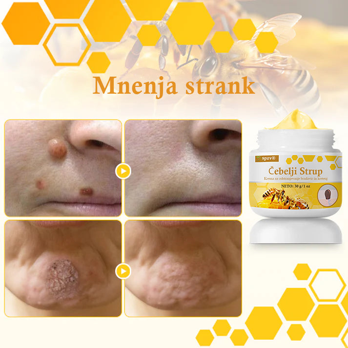 🐝𝐒𝐩𝐳𝐯® Č𝐞𝐛𝐞𝐥𝐣𝐢 𝐒𝐭𝐫𝐮𝐩 𝐊𝐫𝐞𝐦𝐚 𝐳𝐚 𝐨𝐝𝐬𝐭𝐫𝐚𝐧𝐣𝐞𝐯𝐚𝐧𝐣𝐞 𝐛𝐫𝐚𝐝𝐚𝐯𝐢𝐜 𝐢𝐧 𝐤𝐫𝐞𝐭𝐞𝐧𝐣, Certificirano s strani JAZMP (Slovenska agencija za zdravila in medicinske pripomočke) 💖 Zdravi bradavice, kožne izrastke, okužbe in keratozo, gladi neenakomerno kožo