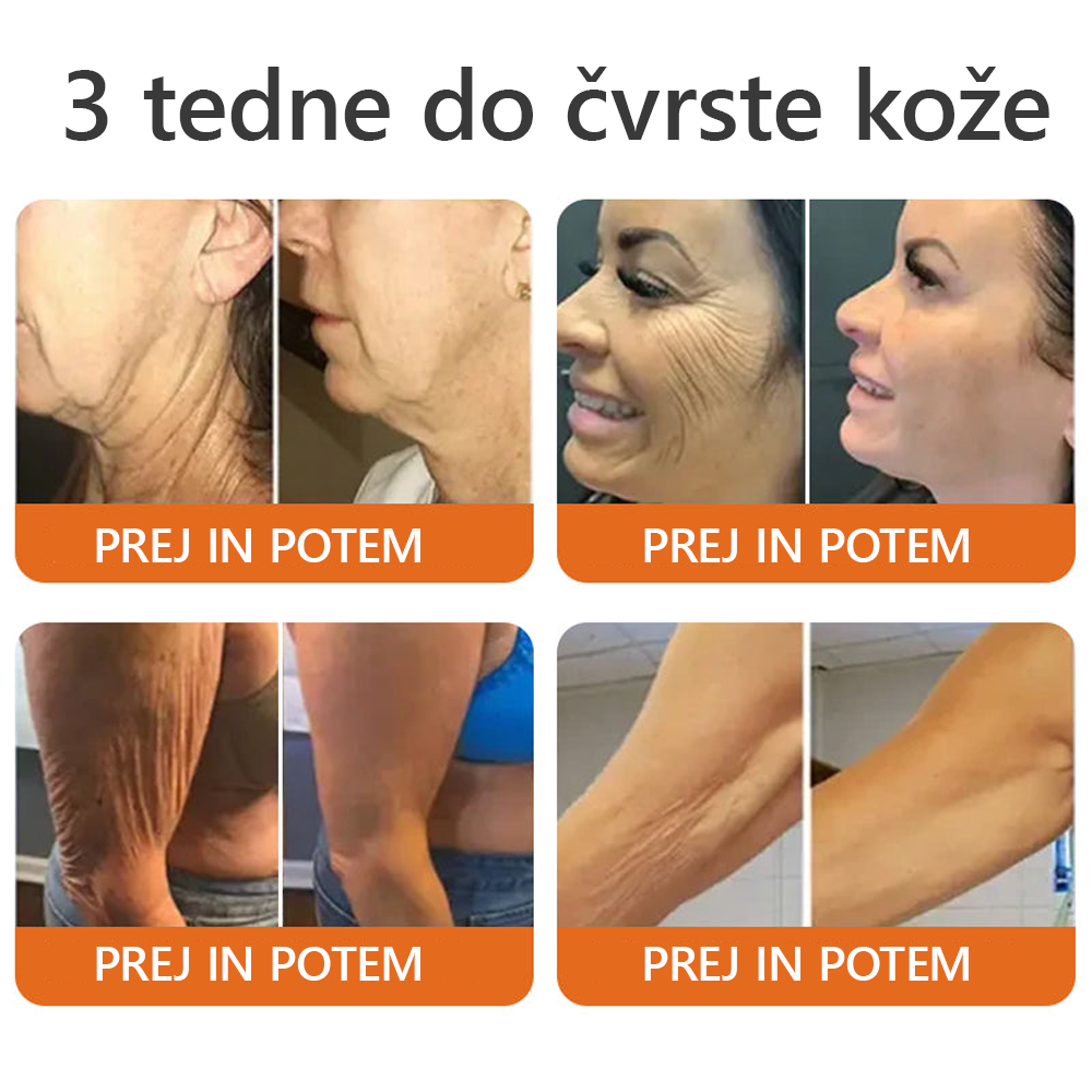 Izdelano in poslano iz Slovenije ✨✨Dormorna® Čebelji strup Celovita krema 🔥 ZADNJI DAN 80 % CENEJE💎💎
