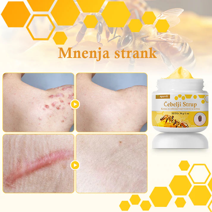 🐝𝐒𝐩𝐳𝐯® Č𝐞𝐛𝐞𝐥𝐣𝐢 𝐒𝐭𝐫𝐮𝐩 𝐊𝐫𝐞𝐦𝐚 𝐳𝐚 𝐨𝐝𝐬𝐭𝐫𝐚𝐧𝐣𝐞𝐯𝐚𝐧𝐣𝐞 𝐛𝐫𝐚𝐝𝐚𝐯𝐢𝐜 𝐢𝐧 𝐤𝐫𝐞𝐭𝐞𝐧𝐣, Certificirano s strani JAZMP (Slovenska agencija za zdravila in medicinske pripomočke) 💖 Zdravi bradavice, kožne izrastke, okužbe in keratozo, gladi neenakomerno kožo