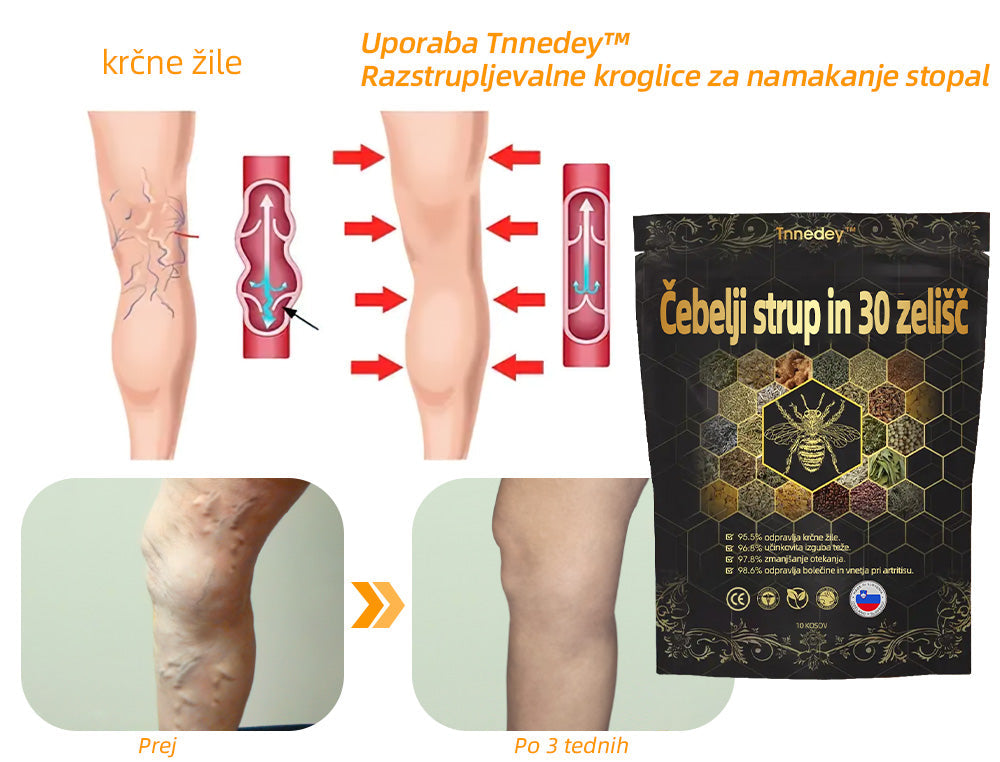 💎📦Zadnji dan, da bi dobili 70% OFF: Tnnedey® 𝑽č𝒆𝒍í 𝒋𝒆𝒅 𝒂 30 𝒃𝒚𝒍𝒊𝒏𝒏é 𝒅𝒆𝒕𝒐𝒙𝒊𝒌𝒂č𝒏é 𝒈𝒖ľôč𝒌𝒚 𝒏𝒂 𝒌ú𝒑𝒆ľ 𝒏ô𝒉 𝒑𝒓𝒆 𝒕𝒗𝒂𝒓𝒐𝒗𝒂𝒏𝒊𝒆 𝒕𝒆𝒍𝒂- Priporoča Ameriška limfna akademija (ALA)🧀