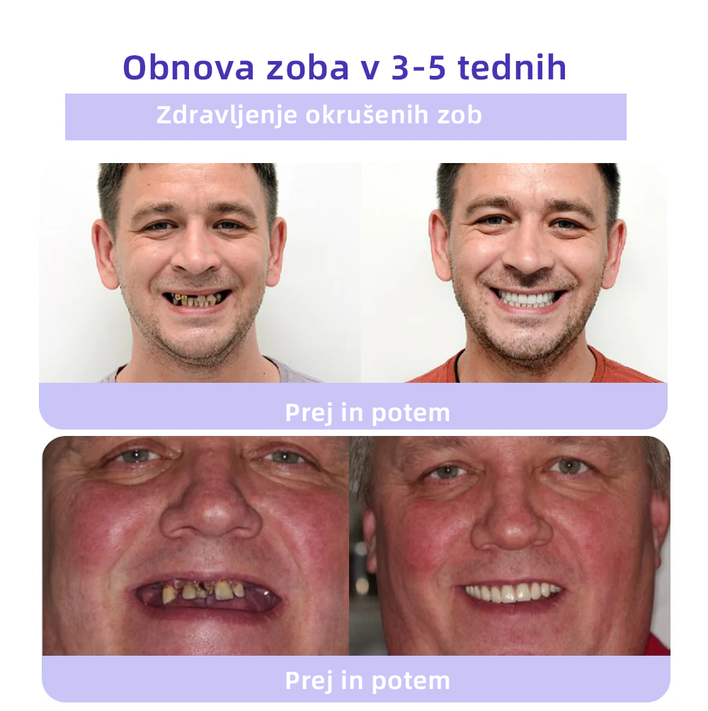 𝐎𝐲𝐢𝐤𝐞𝐲™ Mineralni prah za obnovo zob 🦷 (Priporočeno s strani SDA) (🎁 Časovno omejena akcija - Ne zamudite)