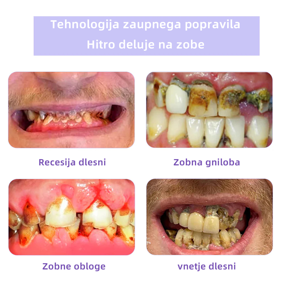 𝐎𝐲𝐢𝐤𝐞𝐲™ Mineralni prah za obnovo zob 🦷 (Priporočeno s strani SDA) (🎁 Časovno omejena akcija - Ne zamudite)