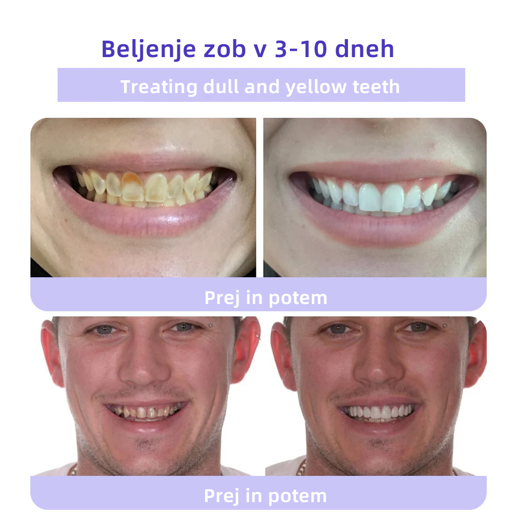 𝐎𝐲𝐢𝐤𝐞𝐲™ Mineralni prah za obnovo zob 🦷 (Priporočeno s strani SDA) (🎁 Časovno omejena akcija - Ne zamudite)