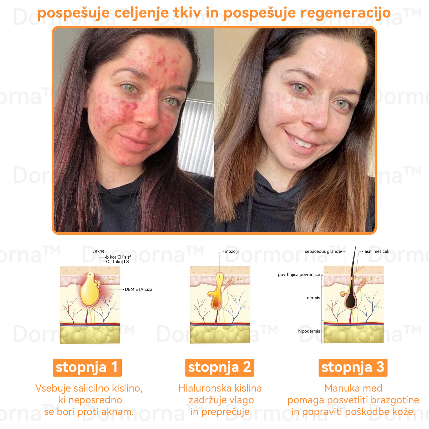 ✅𝐔𝐫𝐚𝐝𝐧𝐚 𝐭𝐫𝐠𝐨𝐯𝐢𝐧𝐚:𝐷𝑜𝑟𝑚𝑜𝑟𝑛𝑎™📦 č𝑒𝑏𝑒𝑙𝑗𝑖 𝑠𝑡𝑟𝑢𝑝 𝑣𝑠𝑒-𝑣-𝑒𝑛𝑒𝑚 𝑘𝑟𝑒𝑚 (JAZMP pričevanja)👨‍⚕️⭐