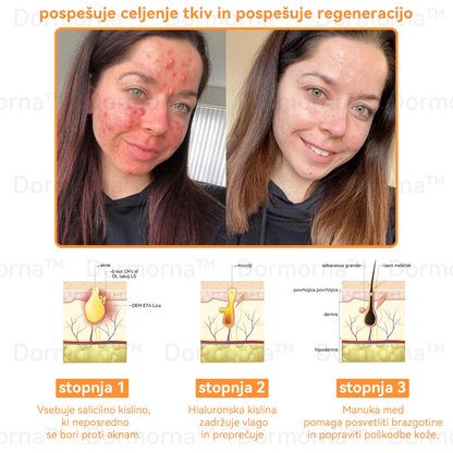 ✅𝐔𝐫𝐚𝐝𝐧𝐚 𝐭𝐫𝐠𝐨𝐯𝐢𝐧𝐚:𝐷𝑜𝑟𝑚𝑜𝑟𝑛𝑎™📦 č𝑒𝑏𝑒𝑙𝑗𝑖 𝑠𝑡𝑟𝑢𝑝 𝑣𝑠𝑒-𝑣-𝑒𝑛𝑒𝑚 𝑘𝑟𝑒𝑚 (JAZMP pričevanja)👨‍⚕️⭐