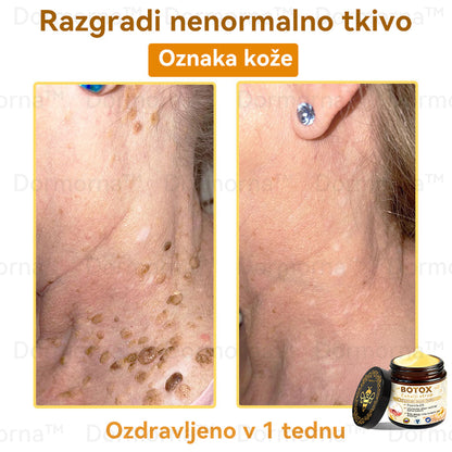Uradnik klinike Mayo: 🦋𝐒𝐩𝐳𝐯™ 𝐁𝐎𝐓𝐎𝐗 Č𝐞𝐛𝐞𝐥𝐣𝐢 𝐬𝐭𝐫𝐮𝐩 𝐊𝐫𝐞𝐦𝐚 𝐳𝐚 𝐧𝐞𝐠𝐨 𝐤𝐨ž𝐞, Vlaženje, popravilo kože, enakomeren ten, zdravljenje aken in temnih madežev, odstranjevanje bradavic in madežev, lajšanje luskavice