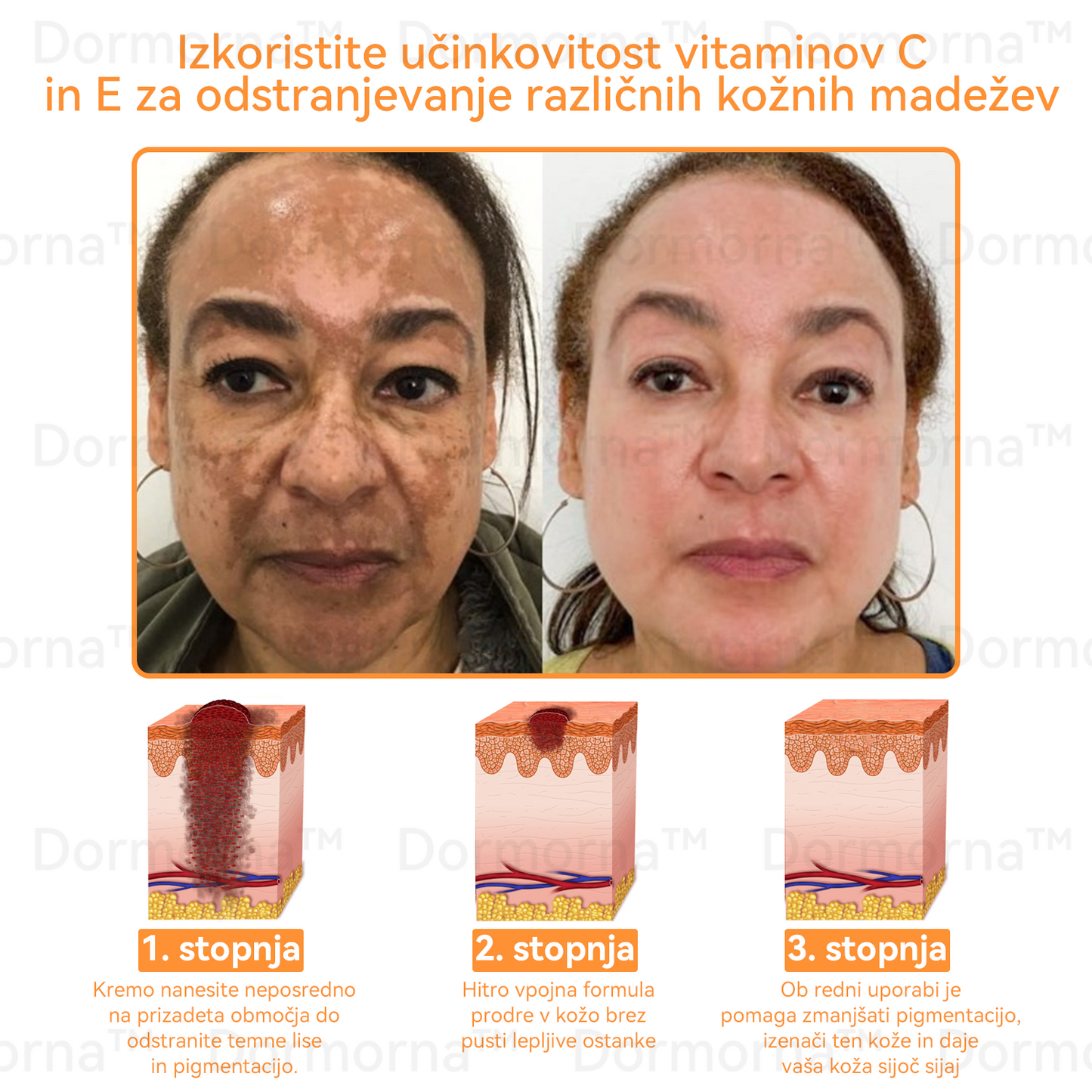 ✅𝐔𝐫𝐚𝐝𝐧𝐚 𝐭𝐫𝐠𝐨𝐯𝐢𝐧𝐚:𝐷𝑜𝑟𝑚𝑜𝑟𝑛𝑎™📦 č𝑒𝑏𝑒𝑙𝑗𝑖 𝑠𝑡𝑟𝑢𝑝 𝑣𝑠𝑒-𝑣-𝑒𝑛𝑒𝑚 𝑘𝑟𝑒𝑚 (JAZMP pričevanja)👨‍⚕️⭐