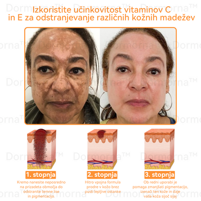 ✅𝐔𝐫𝐚𝐝𝐧𝐚 𝐭𝐫𝐠𝐨𝐯𝐢𝐧𝐚:𝐷𝑜𝑟𝑚𝑜𝑟𝑛𝑎™📦 č𝑒𝑏𝑒𝑙𝑗𝑖 𝑠𝑡𝑟𝑢𝑝 𝑣𝑠𝑒-𝑣-𝑒𝑛𝑒𝑚 𝑘𝑟𝑒𝑚 (JAZMP pričevanja)👨‍⚕️⭐