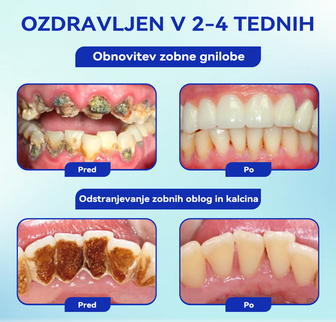 [✅Uradna trgovina]:𝐁𝐢𝐤𝐞𝐧𝐝𝐚™💥💥𝑂𝑠𝑟𝑒𝑑𝑜𝑡𝑖𝑡𝑒 𝑠𝑒 𝑛𝑎 𝑆𝑚𝑖𝑙𝑒 – 𝑃𝑒𝑟𝑜𝑟𝑎𝑙𝑛𝑖 𝑝𝑟𝑎š𝑒𝑘 𝑧 𝑏𝑒𝑒 𝑣𝑒𝑛𝑜𝑚 (👩🏻‍⚕️𝑃𝑟𝑖𝑝𝑜𝑟𝑜č𝑎 𝑧𝑜𝑏𝑛𝑎 𝑧𝑑𝑟𝑎𝑣𝑛𝑖š𝑘𝑎 𝑧𝑣𝑒𝑧𝑎)