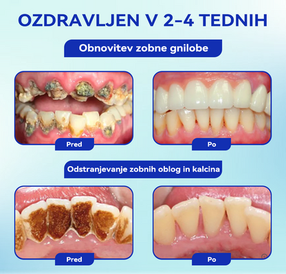 [✅Uradna trgovina]:𝐁𝐢𝐤𝐞𝐧𝐝𝐚™💥💥𝑂𝑠𝑟𝑒𝑑𝑜𝑡𝑖𝑡𝑒 𝑠𝑒 𝑛𝑎 𝑆𝑚𝑖𝑙𝑒 – 𝑃𝑒𝑟𝑜𝑟𝑎𝑙𝑛𝑖 𝑝𝑟𝑎š𝑒𝑘 𝑧 𝑏𝑒𝑒 𝑣𝑒𝑛𝑜𝑚 (👩🏻‍⚕️𝑃𝑟𝑖𝑝𝑜𝑟𝑜č𝑎 𝑧𝑜𝑏𝑛𝑎 𝑧𝑑𝑟𝑎𝑣𝑛𝑖š𝑘𝑎 𝑧𝑣𝑒𝑧𝑎)