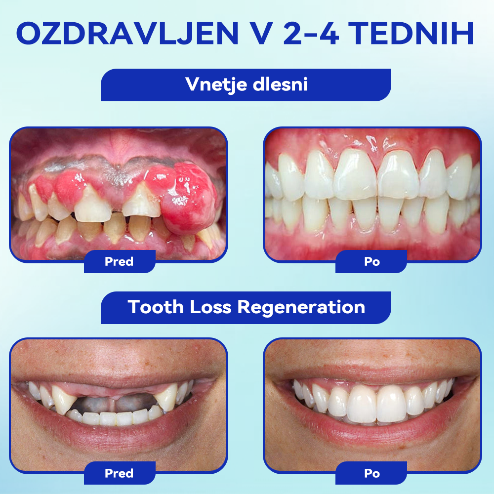 [✅Uradna trgovina]:𝐁𝐢𝐤𝐞𝐧𝐝𝐚™💥💥𝑂𝑠𝑟𝑒𝑑𝑜𝑡𝑖𝑡𝑒 𝑠𝑒 𝑛𝑎 𝑆𝑚𝑖𝑙𝑒 – 𝑃𝑒𝑟𝑜𝑟𝑎𝑙𝑛𝑖 𝑝𝑟𝑎š𝑒𝑘 𝑧 𝑏𝑒𝑒 𝑣𝑒𝑛𝑜𝑚 (👩🏻‍⚕️𝑃𝑟𝑖𝑝𝑜𝑟𝑜č𝑎 𝑧𝑜𝑏𝑛𝑎 𝑧𝑑𝑟𝑎𝑣𝑛𝑖š𝑘𝑎 𝑧𝑣𝑒𝑧𝑎)