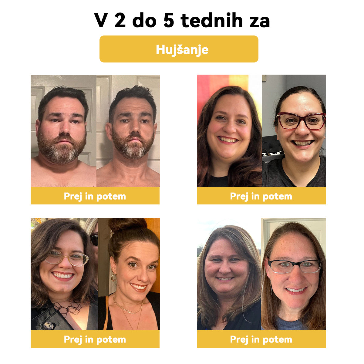 🌷✨𝑺𝑷𝒁𝑽™ Č𝐞𝐛𝐞𝐥𝐣𝐢 𝐬𝐭𝐫𝐮𝐩 𝐎𝐛𝐥𝐢ž 𝐳𝐚 𝐫𝐚𝐳𝐬𝐭𝐫𝐮𝐩𝐥𝐣𝐚𝐧𝐣𝐞（𝐙𝐚 𝐯𝐬𝐞 𝐭𝐞ž𝐚𝐯𝐞 𝐳 𝐝𝐞𝐛𝐞𝐥𝐨𝐬𝐭𝐣𝐨 𝐢𝐧 𝐥𝐢𝐦𝐟𝐨）
