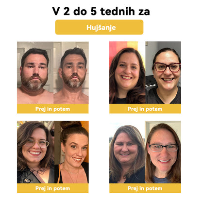 🌷✨𝑺𝑷𝒁𝑽™ Č𝐞𝐛𝐞𝐥𝐣𝐢 𝐬𝐭𝐫𝐮𝐩 𝐎𝐛𝐥𝐢ž 𝐳𝐚 𝐫𝐚𝐳𝐬𝐭𝐫𝐮𝐩𝐥𝐣𝐚𝐧𝐣𝐞（𝐙𝐚 𝐯𝐬𝐞 𝐭𝐞ž𝐚𝐯𝐞 𝐳 𝐝𝐞𝐛𝐞𝐥𝐨𝐬𝐭𝐣𝐨 𝐢𝐧 𝐥𝐢𝐦𝐟𝐨）