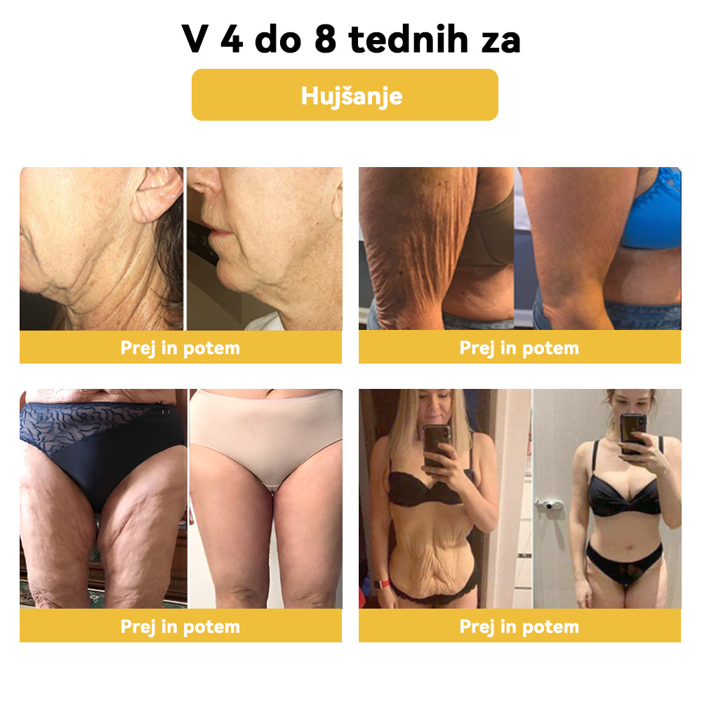 🌷✨𝑺𝑷𝒁𝑽™ Č𝐞𝐛𝐞𝐥𝐣𝐢 𝐬𝐭𝐫𝐮𝐩 𝐎𝐛𝐥𝐢ž 𝐳𝐚 𝐫𝐚𝐳𝐬𝐭𝐫𝐮𝐩𝐥𝐣𝐚𝐧𝐣𝐞（𝐙𝐚 𝐯𝐬𝐞 𝐭𝐞ž𝐚𝐯𝐞 𝐳 𝐝𝐞𝐛𝐞𝐥𝐨𝐬𝐭𝐣𝐨 𝐢𝐧 𝐥𝐢𝐦𝐟𝐨）