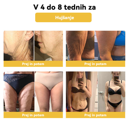 🌷✨𝑺𝑷𝒁𝑽™ Č𝐞𝐛𝐞𝐥𝐣𝐢 𝐬𝐭𝐫𝐮𝐩 𝐎𝐛𝐥𝐢ž 𝐳𝐚 𝐫𝐚𝐳𝐬𝐭𝐫𝐮𝐩𝐥𝐣𝐚𝐧𝐣𝐞（𝐙𝐚 𝐯𝐬𝐞 𝐭𝐞ž𝐚𝐯𝐞 𝐳 𝐝𝐞𝐛𝐞𝐥𝐨𝐬𝐭𝐣𝐨 𝐢𝐧 𝐥𝐢𝐦𝐟𝐨）
