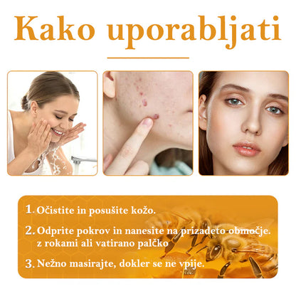 🐝𝐒𝐩𝐳𝐯® Č𝐞𝐛𝐞𝐥𝐣𝐢 𝐒𝐭𝐫𝐮𝐩 𝐊𝐫𝐞𝐦𝐚 𝐳𝐚 𝐨𝐝𝐬𝐭𝐫𝐚𝐧𝐣𝐞𝐯𝐚𝐧𝐣𝐞 𝐛𝐫𝐚𝐝𝐚𝐯𝐢𝐜 𝐢𝐧 𝐤𝐫𝐞𝐭𝐞𝐧𝐣, Certificirano s strani JAZMP (Slovenska agencija za zdravila in medicinske pripomočke) 💖 Zdravi bradavice, kožne izrastke, okužbe in keratozo, gladi neenakomerno kožo