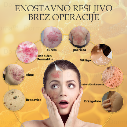 ✅Uradna trgovina:𝐷𝑜𝑟𝑚𝑜𝑟𝑛𝑎™💎Č𝑒𝑏𝑒𝑙𝑗𝑖 𝑆𝑡𝑟𝑢𝑝 𝑃𝑜𝑝𝑜𝑙𝑛𝑎 𝑃𝑜𝑝𝑟𝑎𝑣𝑖𝑙𝑜 𝑍𝑑𝑟𝑎𝑣𝑙𝑗𝑒𝑛𝑗𝑒 𝑆𝑚𝑒𝑡𝑎𝑛𝑎 (👩‍⚕️👩‍⚕️𝐒𝐃𝐕𝐃 𝐩𝐫𝐢𝐩𝐨𝐫𝐨č𝐞𝐧𝐨)-𝑂𝑑𝑠𝑡𝑟𝑎𝑛𝑖𝑡𝑒 𝑚𝑎𝑑𝑒ž𝑒, 𝑏𝑟𝑎𝑑𝑎𝑣𝑖𝑐𝑒, ℎ𝑖𝑝𝑒𝑟𝑝𝑖𝑔𝑚𝑒𝑛𝑡𝑎𝑐𝑖𝑗𝑜, 𝑠𝑡𝑎𝑟𝑜𝑠𝑡𝑛𝑒 𝑝𝑒𝑔𝑒, 𝑎𝑘𝑛𝑒, 𝑏𝑟𝑎𝑧𝑔𝑜𝑡𝑖𝑛𝑒 🥇🥇🥇