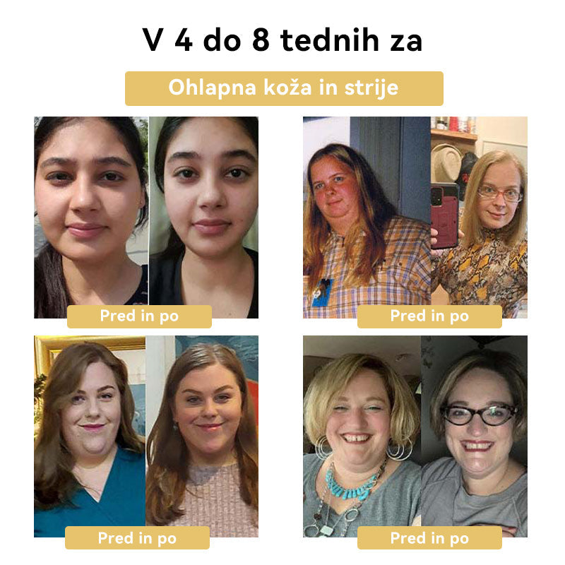 🥜𝑭𝑹𝑶𝑷𝑼𝑵™𝑲𝒓𝒆𝒎𝒂 𝒛𝒂 𝒉𝒖𝒋š𝒂𝒏𝒋𝒆 𝒔 č𝒆𝒃𝒆𝒍𝒋𝒊𝒎 𝒔𝒕𝒓𝒖𝒑𝒐𝒎⭐(𝒁𝒂 𝒗𝒔𝒆 𝒍𝒊𝒎𝒇𝒏𝒆 𝒕𝒆ž𝒂𝒗𝒆 𝒊𝒏 𝒅𝒆𝒃𝒆𝒍𝒐𝒔𝒕)