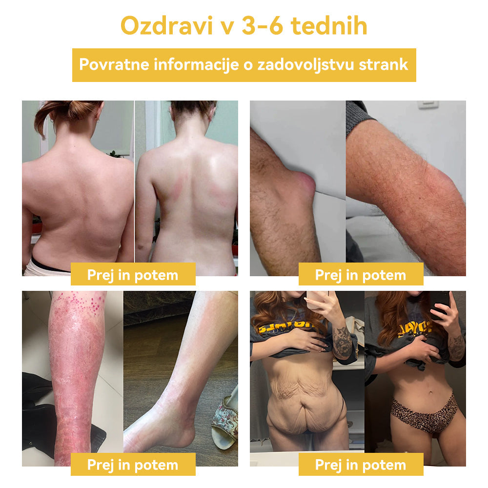 🌷✨𝑺𝑷𝒁𝑽™ Č𝐞𝐛𝐞𝐥𝐣𝐢 𝐬𝐭𝐫𝐮𝐩 𝐎𝐛𝐥𝐢ž 𝐳𝐚 𝐫𝐚𝐳𝐬𝐭𝐫𝐮𝐩𝐥𝐣𝐚𝐧𝐣𝐞（𝐙𝐚 𝐯𝐬𝐞 𝐭𝐞ž𝐚𝐯𝐞 𝐳 𝐝𝐞𝐛𝐞𝐥𝐨𝐬𝐭𝐣𝐨 𝐢𝐧 𝐥𝐢𝐦𝐟𝐨）