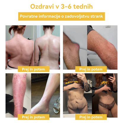 🌷✨𝑺𝑷𝒁𝑽™ Č𝐞𝐛𝐞𝐥𝐣𝐢 𝐬𝐭𝐫𝐮𝐩 𝐎𝐛𝐥𝐢ž 𝐳𝐚 𝐫𝐚𝐳𝐬𝐭𝐫𝐮𝐩𝐥𝐣𝐚𝐧𝐣𝐞（𝐙𝐚 𝐯𝐬𝐞 𝐭𝐞ž𝐚𝐯𝐞 𝐳 𝐝𝐞𝐛𝐞𝐥𝐨𝐬𝐭𝐣𝐨 𝐢𝐧 𝐥𝐢𝐦𝐟𝐨）