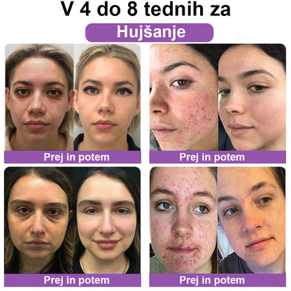 🦄𝐂𝐯𝐫𝐞𝐨𝐳™ Č𝐞𝐛𝐞𝐥𝐣𝐢 𝐬𝐭𝐫𝐮𝐩 𝐍𝐀𝐃+ 𝐍𝐚𝐭𝐮𝐫𝐚𝐥 𝐎𝐛𝐧𝐨𝐯𝐢𝐭𝐯𝐞𝐧𝐞 𝐯𝐚𝐠𝐢𝐧𝐚𝐥𝐧𝐞 𝐤𝐚𝐩𝐬𝐮𝐥𝐞 (Kapsule za zdravje žensk in zdravje kože)