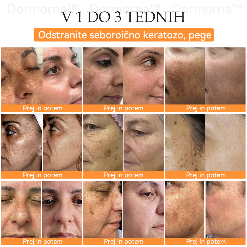 ✅Uradna trgovina:𝐷𝑜𝑟𝑚𝑜𝑟𝑛𝑎™💎Č𝑒𝑏𝑒𝑙𝑗𝑖 𝑆𝑡𝑟𝑢𝑝 𝑃𝑜𝑝𝑜𝑙𝑛𝑎 𝑃𝑜𝑝𝑟𝑎𝑣𝑖𝑙𝑜 𝑍𝑑𝑟𝑎𝑣𝑙𝑗𝑒𝑛𝑗𝑒 𝑆𝑚𝑒𝑡𝑎𝑛𝑎 (👩‍⚕️👩‍⚕️𝐒𝐃𝐕𝐃 𝐩𝐫𝐢𝐩𝐨𝐫𝐨č𝐞𝐧𝐨)-𝑂𝑑𝑠𝑡𝑟𝑎𝑛𝑖𝑡𝑒 𝑚𝑎𝑑𝑒ž𝑒, 𝑏𝑟𝑎𝑑𝑎𝑣𝑖𝑐𝑒, ℎ𝑖𝑝𝑒𝑟𝑝𝑖𝑔𝑚𝑒𝑛𝑡𝑎𝑐𝑖𝑗𝑜, 𝑠𝑡𝑎𝑟𝑜𝑠𝑡𝑛𝑒 𝑝𝑒𝑔𝑒, 𝑎𝑘𝑛𝑒, 𝑏𝑟𝑎𝑧𝑔𝑜𝑡𝑖𝑛𝑒 🥇🥇🥇