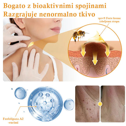 🐝𝐒𝐩𝐳𝐯® Č𝐞𝐛𝐞𝐥𝐣𝐢 𝐒𝐭𝐫𝐮𝐩 𝐊𝐫𝐞𝐦𝐚 𝐳𝐚 𝐨𝐝𝐬𝐭𝐫𝐚𝐧𝐣𝐞𝐯𝐚𝐧𝐣𝐞 𝐛𝐫𝐚𝐝𝐚𝐯𝐢𝐜 𝐢𝐧 𝐤𝐫𝐞𝐭𝐞𝐧𝐣, Certificirano s strani JAZMP (Slovenska agencija za zdravila in medicinske pripomočke) 💖 Zdravi bradavice, kožne izrastke, okužbe in keratozo, gladi neenakomerno kožo