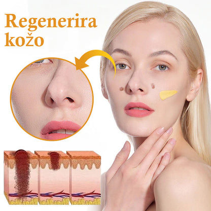 🐝𝐒𝐩𝐳𝐯® Č𝐞𝐛𝐞𝐥𝐣𝐢 𝐒𝐭𝐫𝐮𝐩 𝐊𝐫𝐞𝐦𝐚 𝐳𝐚 𝐨𝐝𝐬𝐭𝐫𝐚𝐧𝐣𝐞𝐯𝐚𝐧𝐣𝐞 𝐛𝐫𝐚𝐝𝐚𝐯𝐢𝐜 𝐢𝐧 𝐤𝐫𝐞𝐭𝐞𝐧𝐣, Certificirano s strani JAZMP (Slovenska agencija za zdravila in medicinske pripomočke) 💖 Zdravi bradavice, kožne izrastke, okužbe in keratozo, gladi neenakomerno kožo