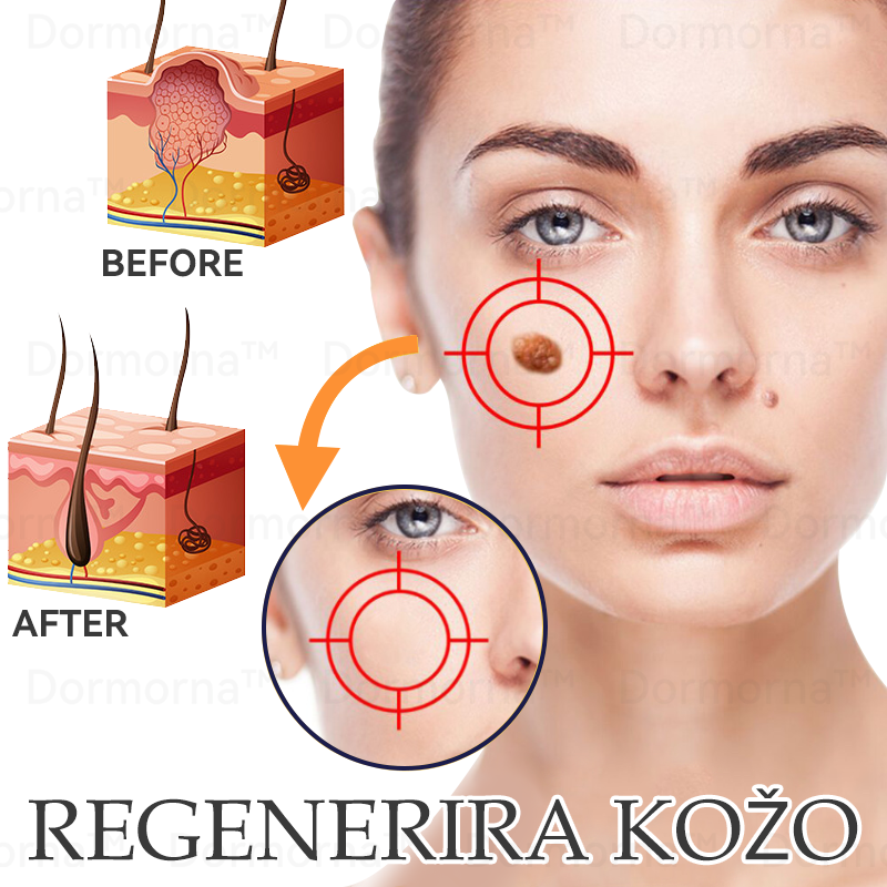 ✅Uradna trgovina:𝐷𝑜𝑟𝑚𝑜𝑟𝑛𝑎™💎Č𝑒𝑏𝑒𝑙𝑗𝑖 𝑆𝑡𝑟𝑢𝑝 𝑃𝑜𝑝𝑜𝑙𝑛𝑎 𝑃𝑜𝑝𝑟𝑎𝑣𝑖𝑙𝑜 𝑍𝑑𝑟𝑎𝑣𝑙𝑗𝑒𝑛𝑗𝑒 𝑆𝑚𝑒𝑡𝑎𝑛𝑎 (👩‍⚕️👩‍⚕️𝐒𝐃𝐕𝐃 𝐩𝐫𝐢𝐩𝐨𝐫𝐨č𝐞𝐧𝐨)-𝑂𝑑𝑠𝑡𝑟𝑎𝑛𝑖𝑡𝑒 𝑚𝑎𝑑𝑒ž𝑒, 𝑏𝑟𝑎𝑑𝑎𝑣𝑖𝑐𝑒, ℎ𝑖𝑝𝑒𝑟𝑝𝑖𝑔𝑚𝑒𝑛𝑡𝑎𝑐𝑖𝑗𝑜, 𝑠𝑡𝑎𝑟𝑜𝑠𝑡𝑛𝑒 𝑝𝑒𝑔𝑒, 𝑎𝑘𝑛𝑒, 𝑏𝑟𝑎𝑧𝑔𝑜𝑡𝑖𝑛𝑒 🥇🥇🥇