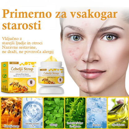 🐝𝐒𝐩𝐳𝐯® Č𝐞𝐛𝐞𝐥𝐣𝐢 𝐒𝐭𝐫𝐮𝐩 𝐊𝐫𝐞𝐦𝐚 𝐳𝐚 𝐨𝐝𝐬𝐭𝐫𝐚𝐧𝐣𝐞𝐯𝐚𝐧𝐣𝐞 𝐛𝐫𝐚𝐝𝐚𝐯𝐢𝐜 𝐢𝐧 𝐤𝐫𝐞𝐭𝐞𝐧𝐣, Certificirano s strani JAZMP (Slovenska agencija za zdravila in medicinske pripomočke) 💖 Zdravi bradavice, kožne izrastke, okužbe in keratozo, gladi neenakomerno kožo