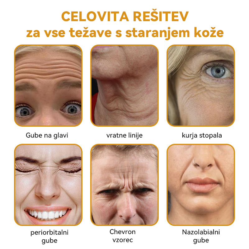 (🎁 Ekskluzivna posebna ponudba - 70 % popust - ne zamudite!) 𝐒𝐩𝐳𝐲™ 𝐁𝐎𝐓𝐎𝐗 Strije proti staranju z medenim strupom