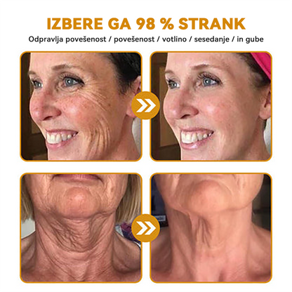 (🎁 Ekskluzivna posebna ponudba - 70 % popust - ne zamudite!) 𝐒𝐩𝐳𝐲™ 𝐁𝐎𝐓𝐎𝐗 Strije proti staranju z medenim strupom