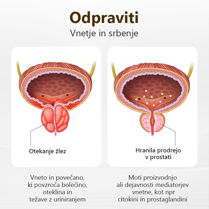 Poslovite se od težav s prostato💎𝐋𝐄𝐅𝐔𝐍𝐓™  𝐢𝐧𝐡𝐚𝐥𝐚𝐜𝐢𝐣𝐬𝐤𝐚 𝐩𝐚𝐥𝐢𝐜𝐚 𝐳 𝐦𝐞𝐝𝐨𝐦🍀(Hitro in dolgotrajno delovanje)