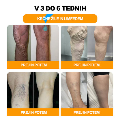 🚚📦Zadnji dan, da bi dobili 70% OFF: Tnnedey® 𝑽č𝒆𝒍í 𝒋𝒆𝒅 𝒂 30 𝒃𝒚𝒍𝒊𝒏𝒏é 𝒅𝒆𝒕𝒐𝒙𝒊𝒌𝒂č𝒏é 𝒈𝒖ľôč𝒌𝒚 𝒏𝒂 𝒌ú𝒑𝒆ľ 𝒏ô𝒉 𝒑𝒓𝒆 𝒕𝒗𝒂𝒓𝒐𝒗𝒂𝒏𝒊𝒆 𝒕𝒆𝒍𝒂- Priporoča Ameriška limfna akademija (ALA)🧀